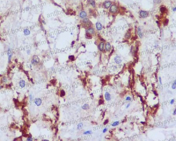 Валидация AntibodySystem RHN60301