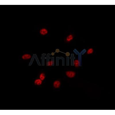 Валидация Affinity DF8648 - 20607