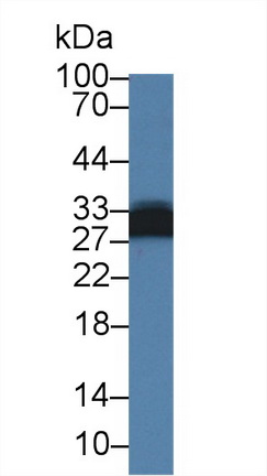 14312
