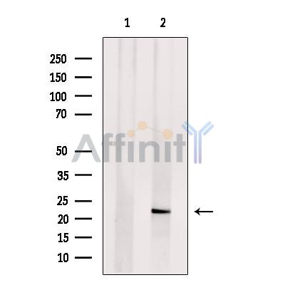 Валидация Affinity DF13585 - 9058