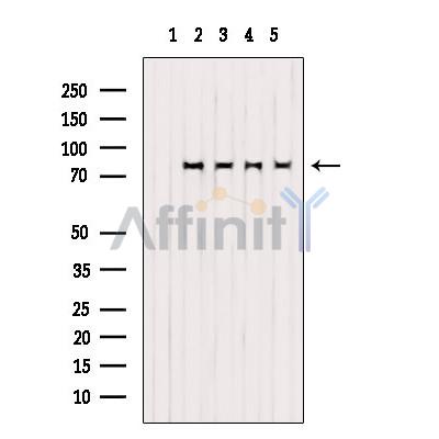 Валидация Affinity AF6295 - 3562