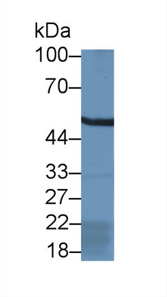 14156