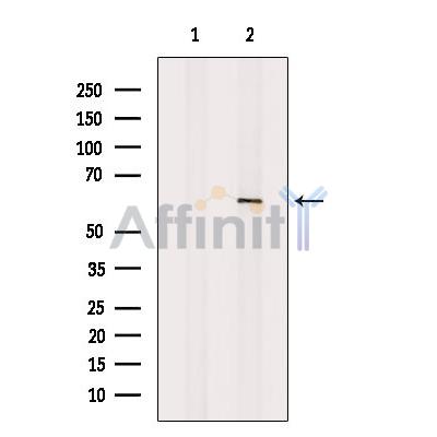 Валидация Affinity DF7202 - 18869