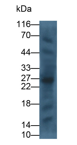 30577