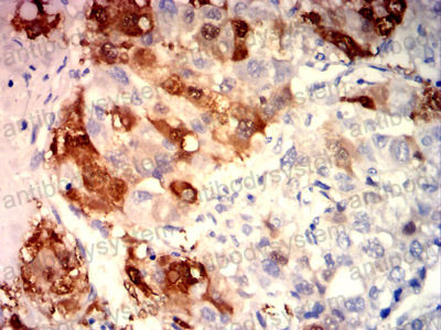 Валидация AntibodySystem RHC12603 (651)