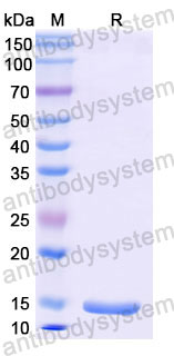Валидация SDS-PAGE - AntibodySystem RVV25604