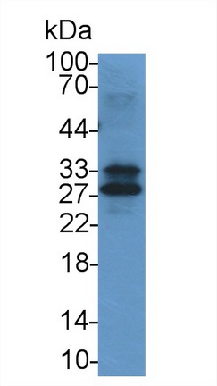 14618