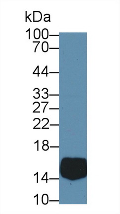 17597