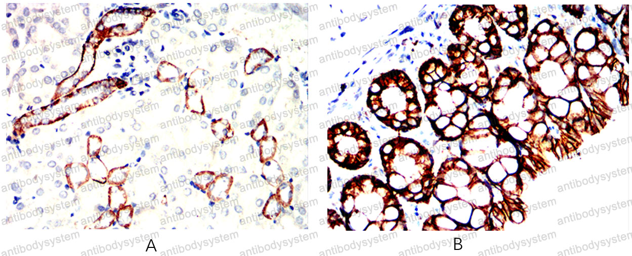 Валидация AntibodySystem RHD17408 (1394)