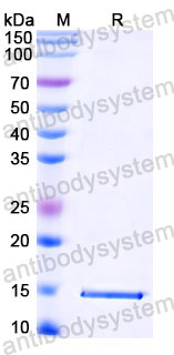 Валидация SDS-PAGE - AntibodySystem RVV03601