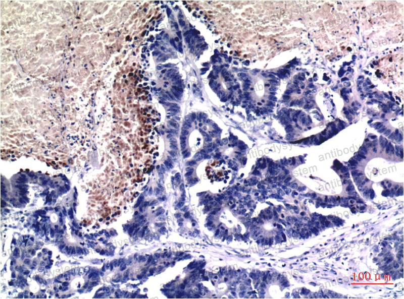 Валидация AntibodySystem RHF62745