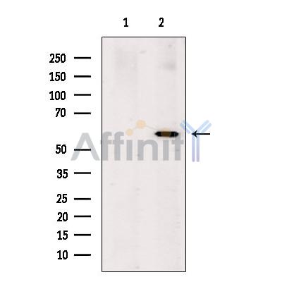 Валидация Affinity DF13527 - 8941