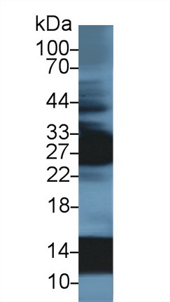 13756