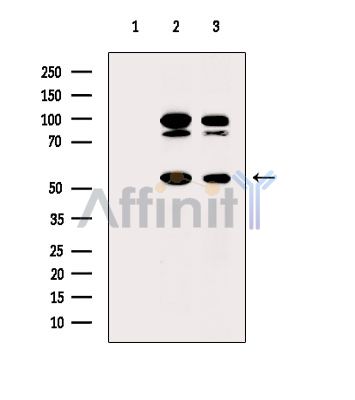 Валидация Affinity DF14581 - 10586