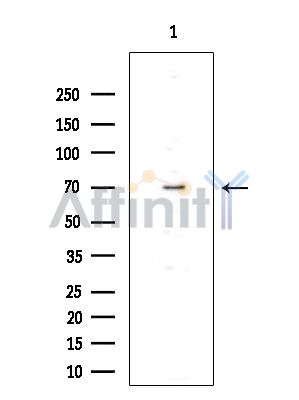 Валидация Affinity DF15311 - 11612