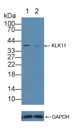 12304