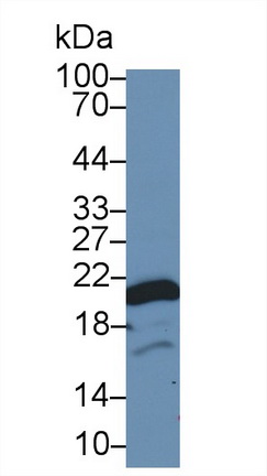 13308