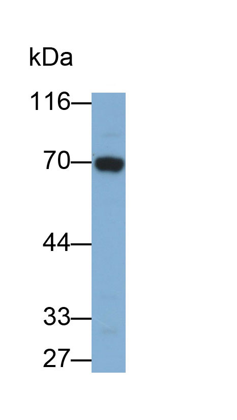 32035