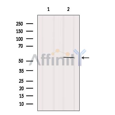 Валидация Affinity AF6368 - 3662