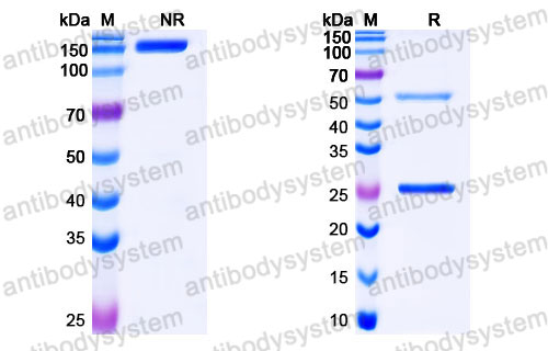 Валидация SDS-PAGE - AntibodySystem FMD76410
