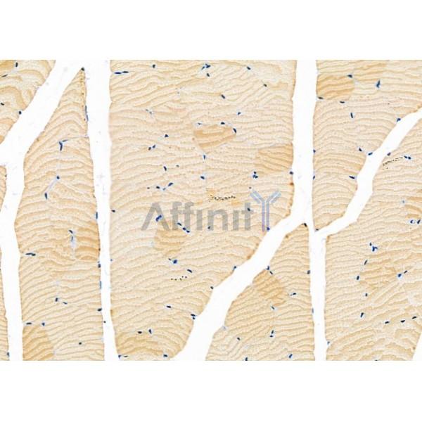 Валидация Affinity DF9557 - 22223