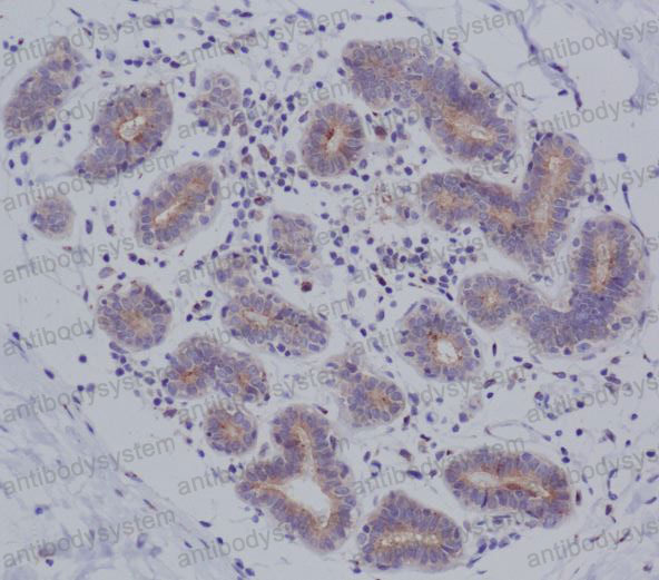 Валидация AntibodySystem RHJ47401