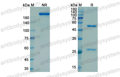 Валидация SDS-PAGE - AntibodySystem DHA95601