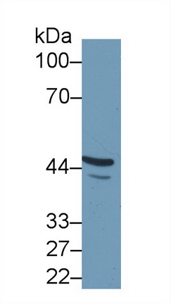 17651
