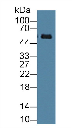 12315
