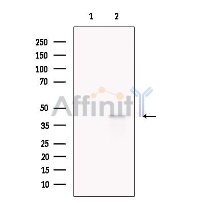 Валидация Affinity DF13749 - 9403