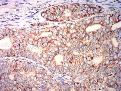 Валидация AntibodySystem RHG39702 (2922)