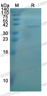 YVV44101, SDS-PAGE