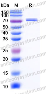 EHJ59601, SDS-PAGE
