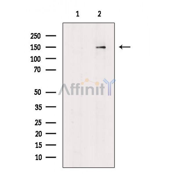 Валидация Affinity DF6144 - 17376