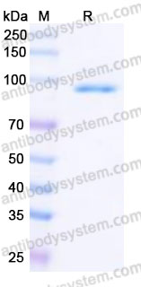 EHE84001, SDS-PAGE