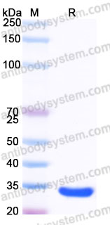 YHG11202, SDS-PAGE