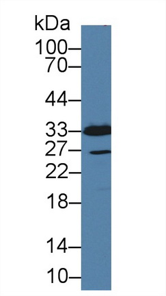 14288