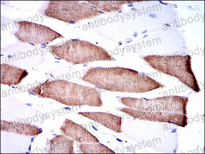 Валидация AntibodySystem RHA28101