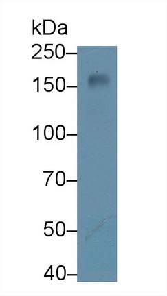 13555