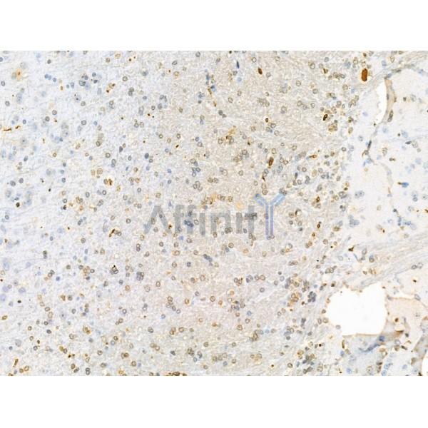 Валидация Affinity DF13363 - 8591