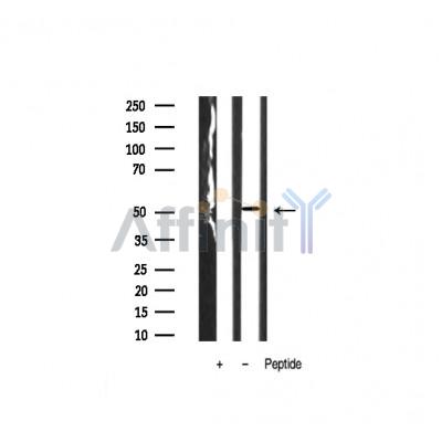 Валидация Affinity AF6492 - 3825