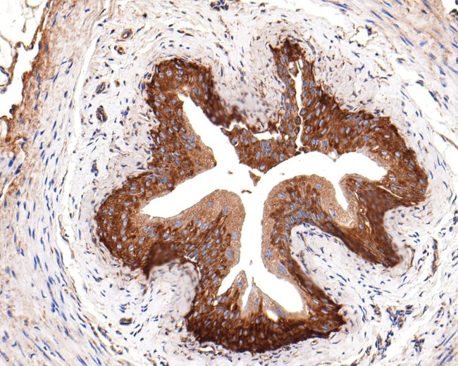 Валидация AssayVector ARM1340(935)