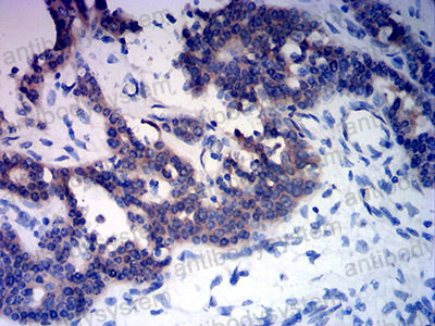 Валидация AntibodySystem RHN98402