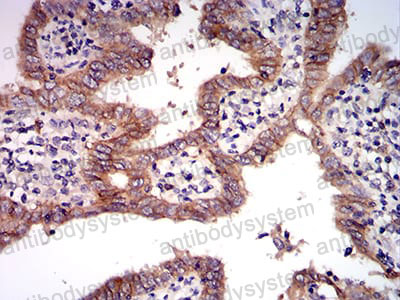 Валидация AntibodySystem RHC34205