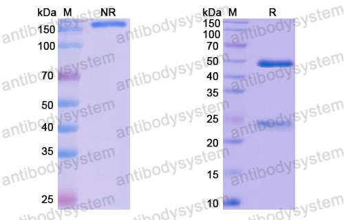 Валидация SDS-PAGE - AntibodySystem FHJ92810