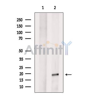 Валидация Affinity DF9048 - 21300