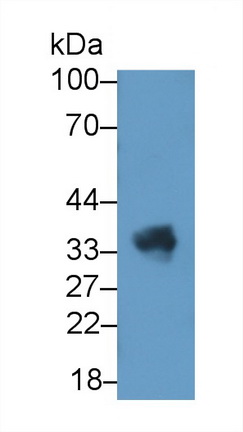 21399