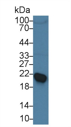 12995