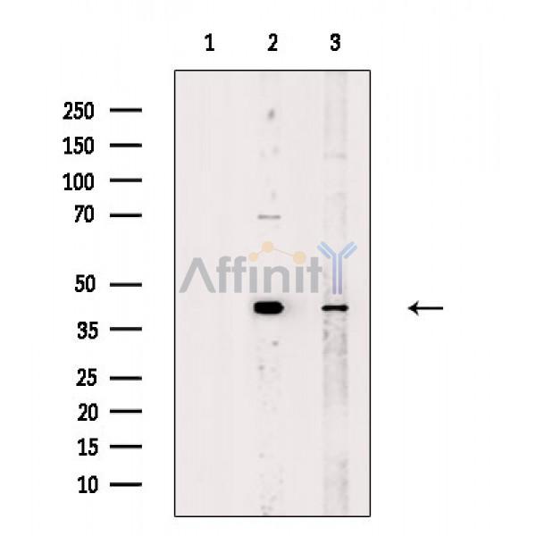 Валидация Affinity DF8562 - 20460