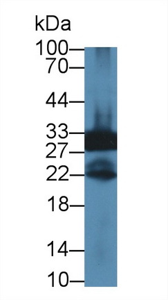 12715